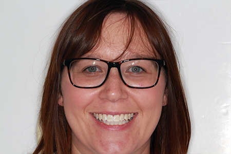 After Invisalign Treatment Smile Rooms Glasgow After Invisalign Treatment Smile Rooms Glasgow