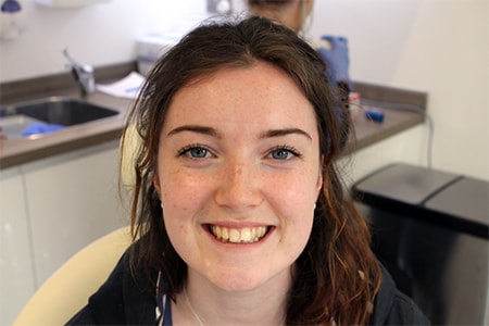 Before Invisalign Treatment Smile Rooms Glasgow Before Invisalign Treatment Smile Rooms Glasgow