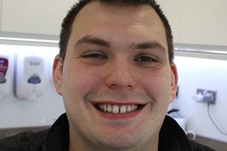 Before Invisalign Treatment Smile Rooms Glasgow Before Invisalign Treatment Smile Rooms Glasgow