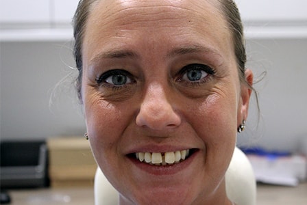 Before Invisalign Treatment Smile Rooms Glasgow Before Invisalign Treatment Smile Rooms Glasgow