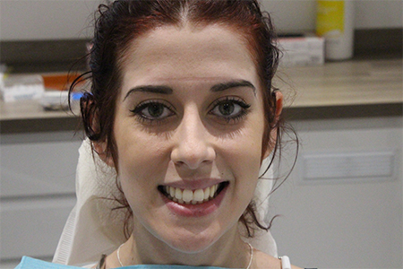 Before Smile Makeover Treatment Smile Rooms Glasgow Before Smile Makeover Treatment Smile Rooms Glasgow
