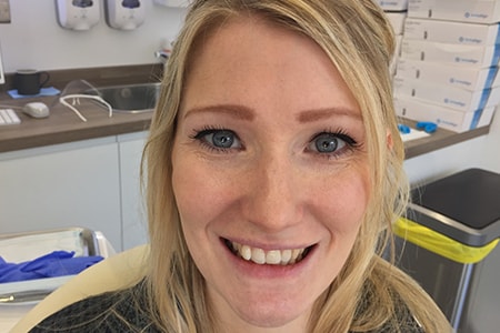 Before Invisalign Treatment Smile Rooms Glasgow Before Invisalign Treatment Smile Rooms Glasgow