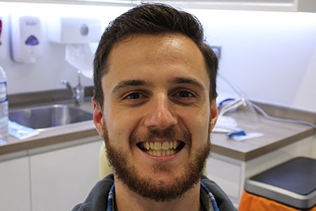 Before Invisalign Treatment Smile Rooms Glasgow Before Invisalign Treatment Smile Rooms Glasgow