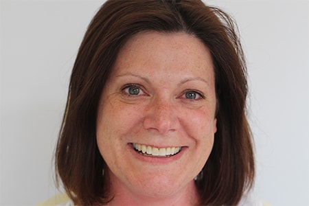 After Invisalign Treatment Smile Rooms Glasgow After Invisalign Treatment Smile Rooms Glasgow