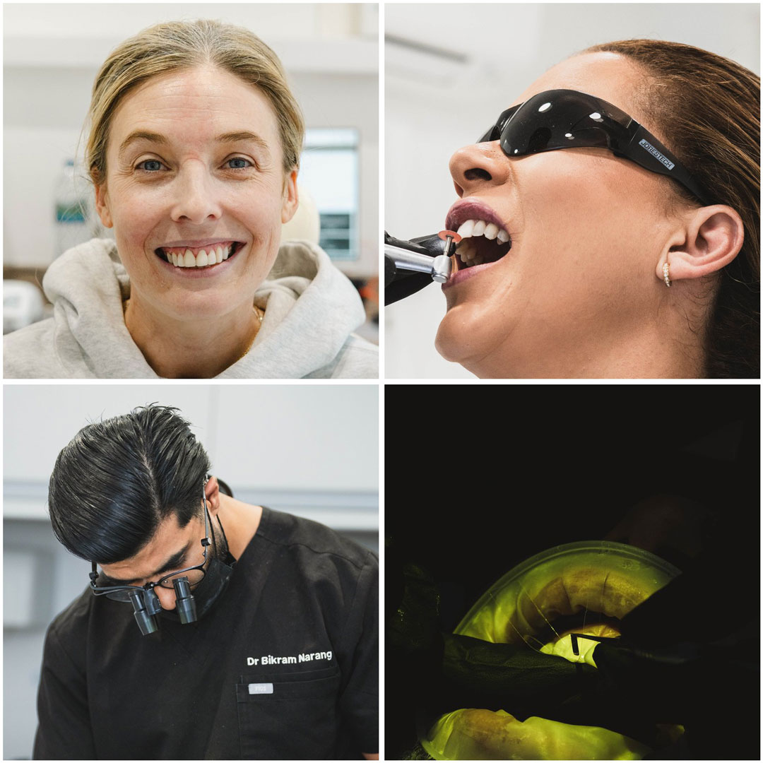 tooth decay at smile rooms Dental abscess and tooth decay treatment in Glasgow